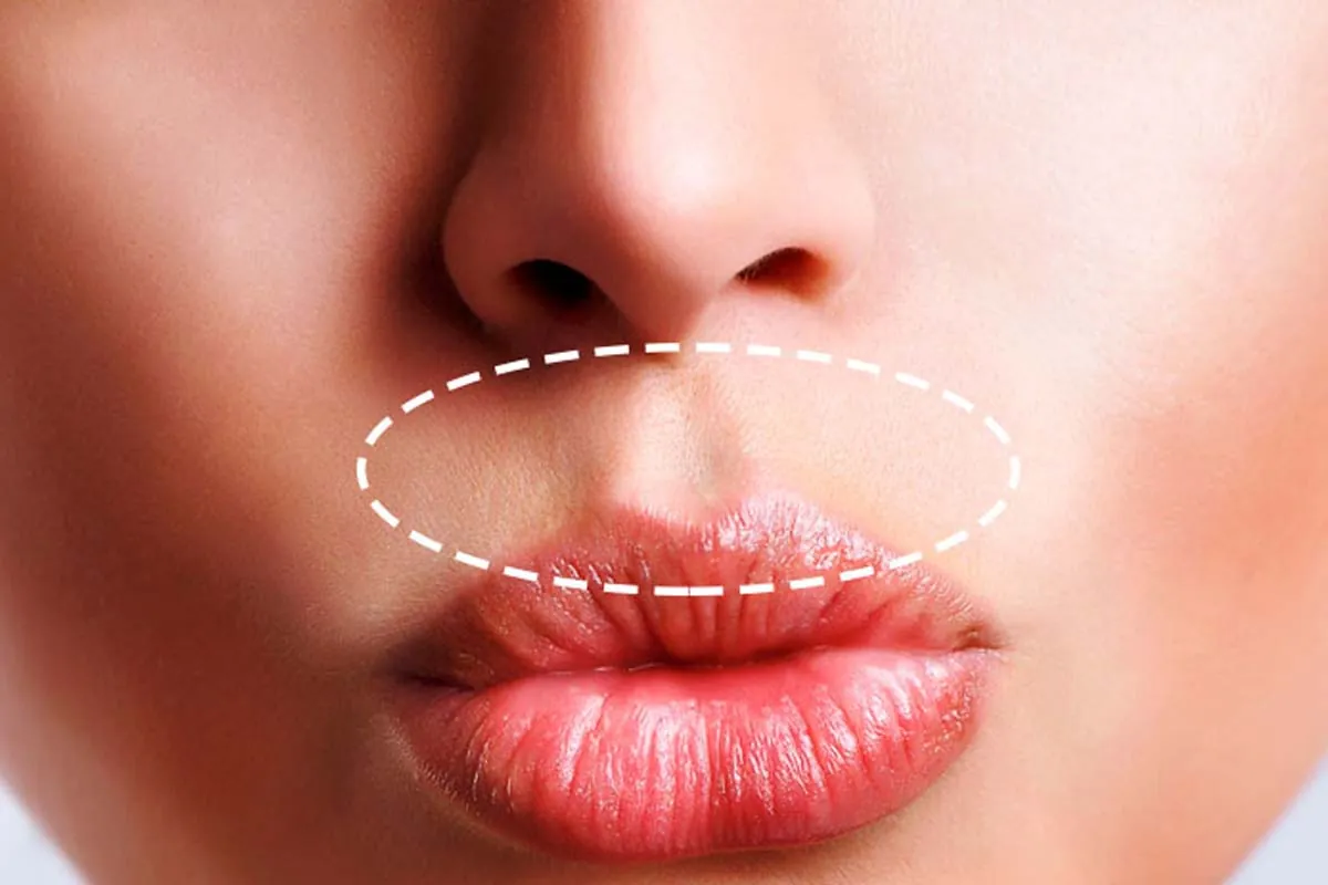 Arrugas del labio superior Primer plano labios con marca en arrugas del código de barras