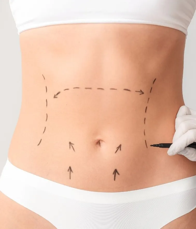 Carboxiterapia corporal en Madrid, Clínica Ibiza