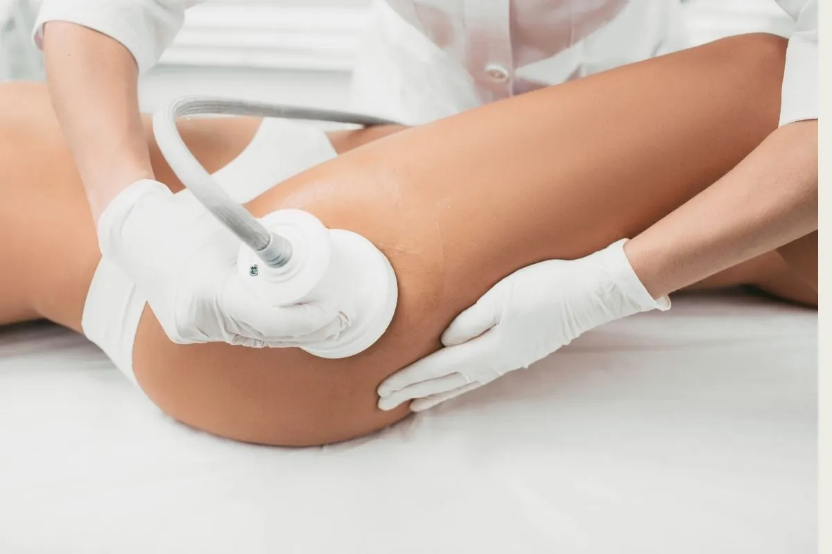 Tratamiento de cavitación para eliminar celulitis en glúteos y piernas
