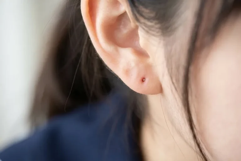 Como cerrar el agujero de piercing