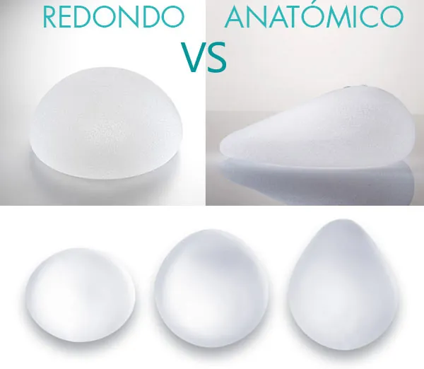 Prótesis redondas vs anatómicas Comparativa entre prótesis mamarias redondas y anatómicas para aumento de pecho