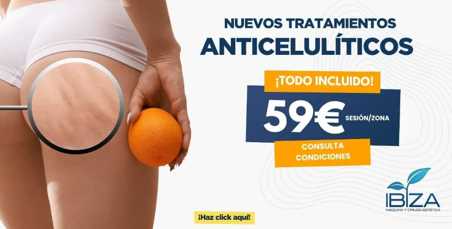Tratamientos anticelulíticos para muslos Promoción nuevos tratamientos anticelulíticos para eliminar celulitis en muslos