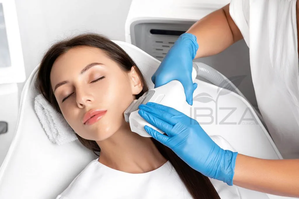 Tratamiento láser contra melasma Mujer recibiendo tratamiento láser facial para eliminar melasma definitivamente
