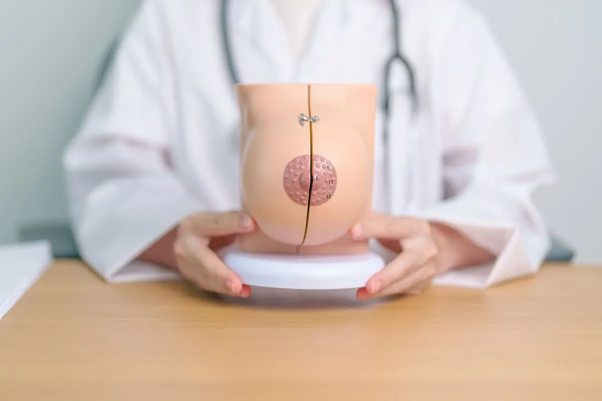 Modelo anatómico mamario Médica sostiene modelo anatómico de mama para explicar ginecomastia