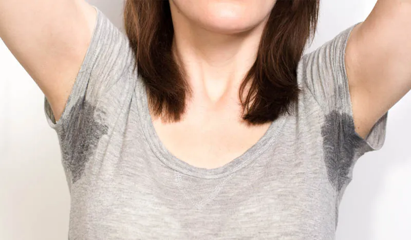 Mujer con manchas de sudor en axilas por hiperhidrosis excesiva