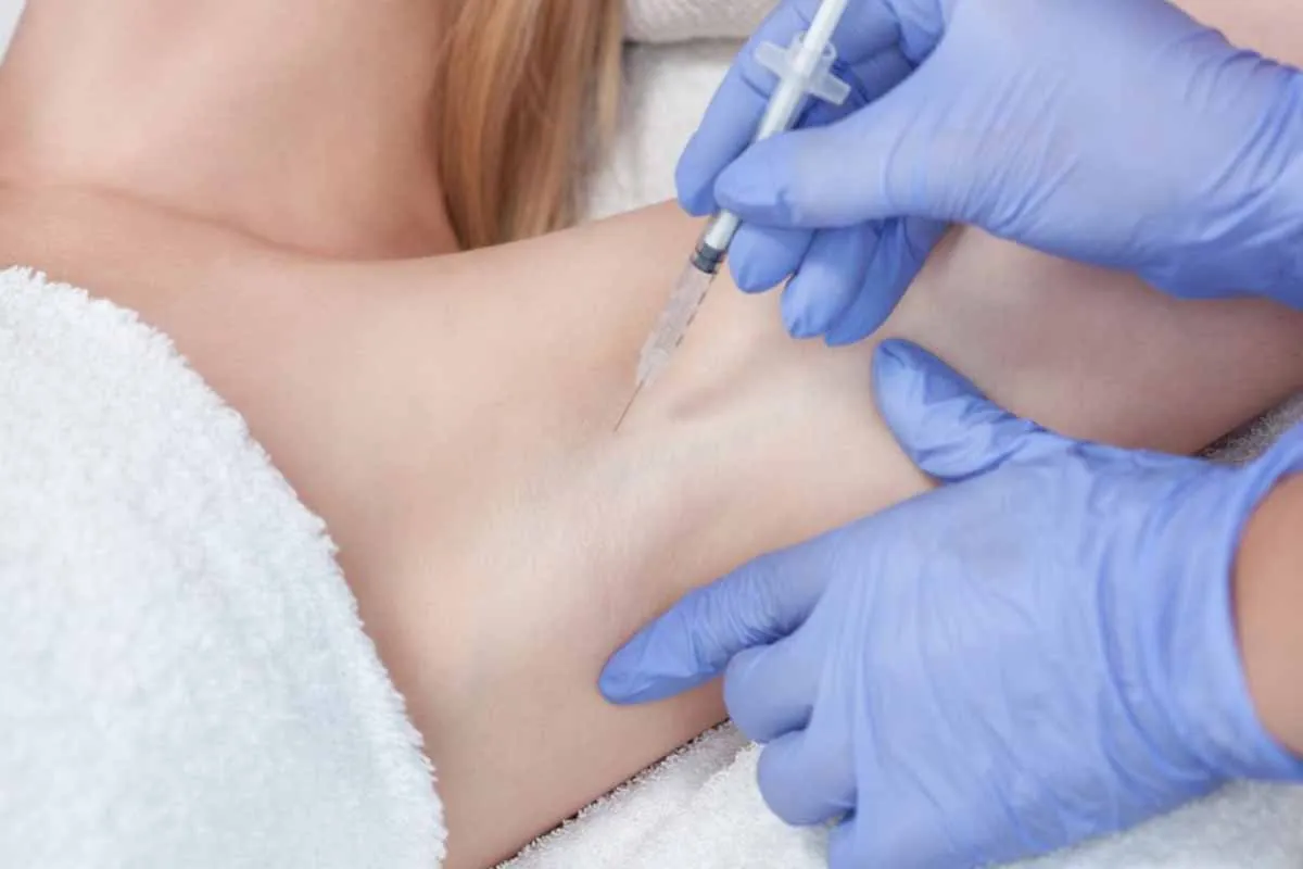 Inyección de toxina botulínica en axila para tratar hiperhidrosis