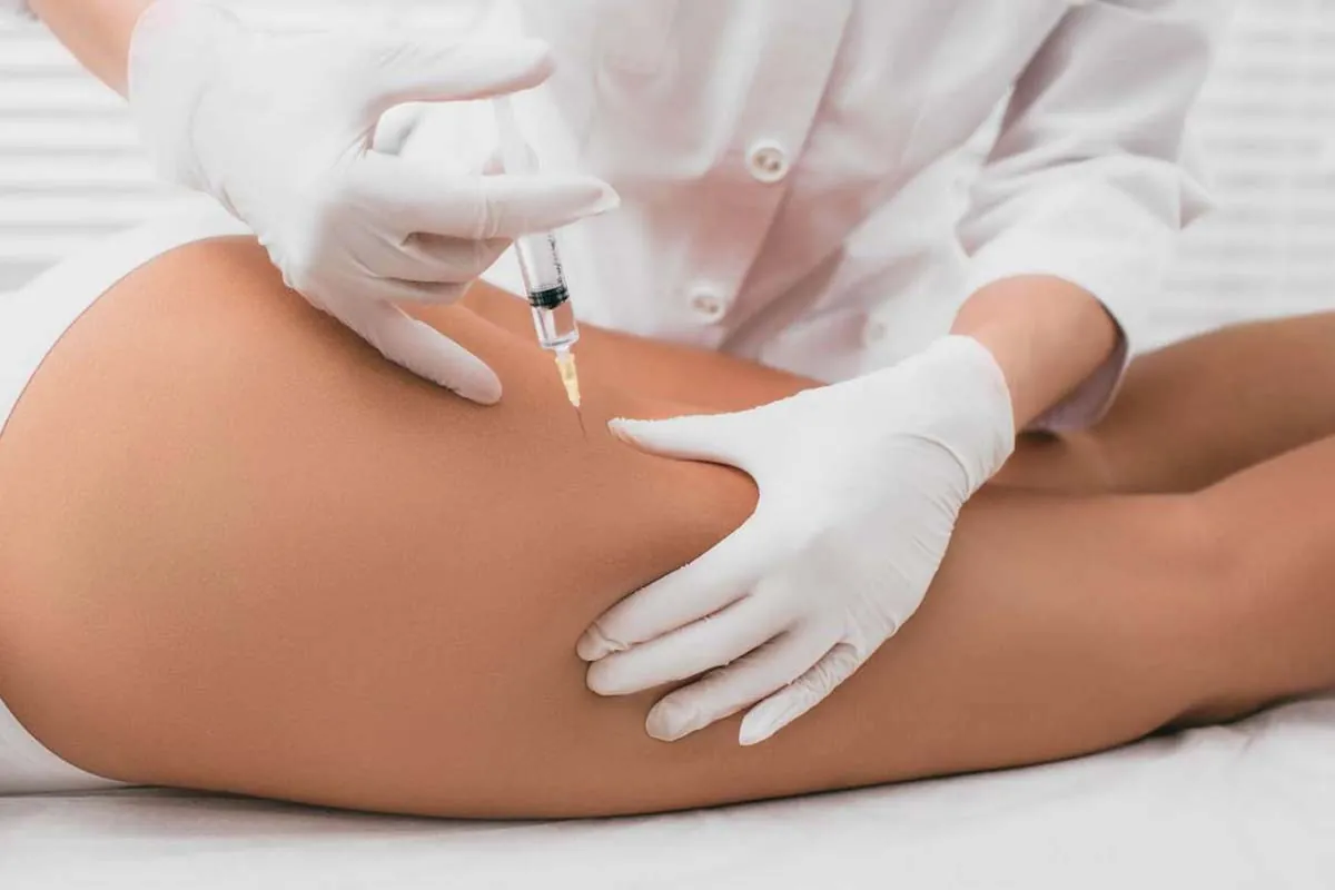 Mesoterapia para cartucheras Mesoterapia aplicada en cartucheras mediante inyección con jeringa
