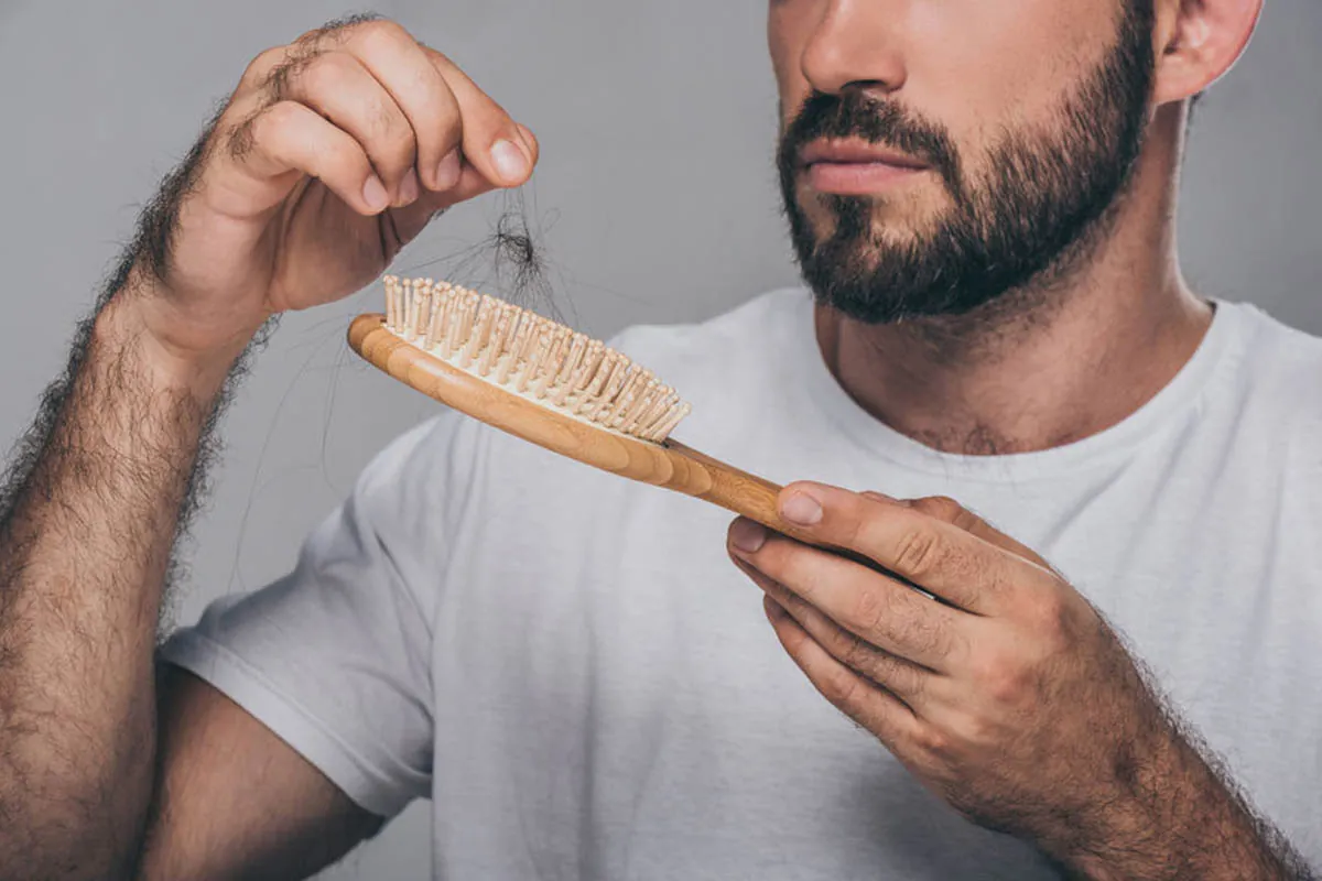 Caída del cabello y minoxidil Hombre observando caída del cabello en cepillo preocupado por alopecia y minoxidil