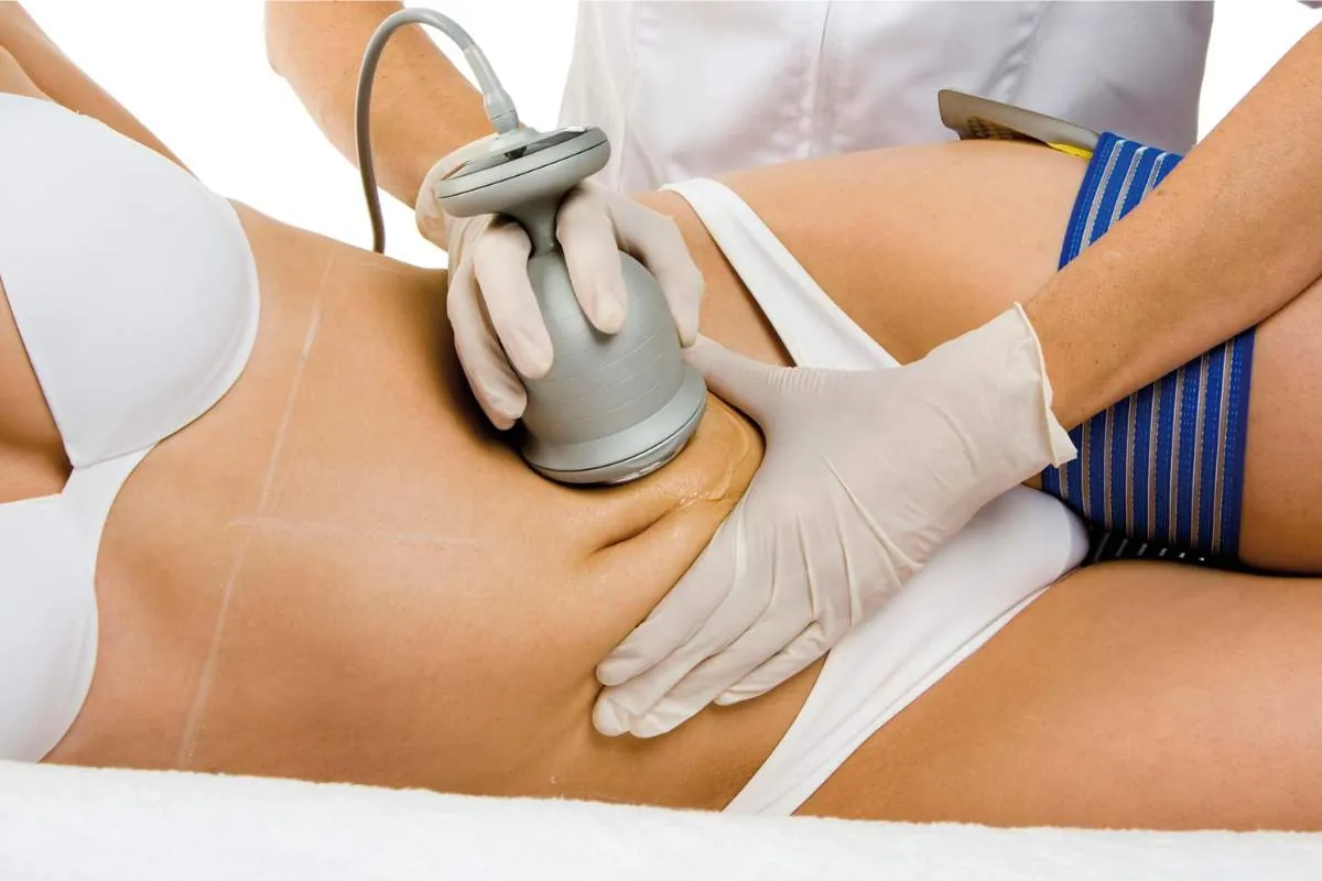 Cavitación estética abdominal Tratamiento de cavitación estética aplicado en zona abdominal de mujer