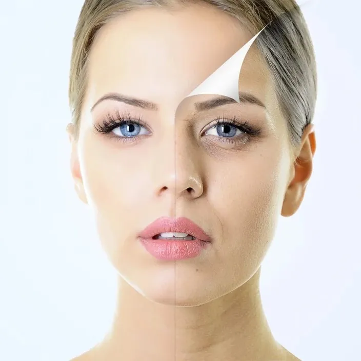 Comparación facial antes y después de tratamiento de resurfacing en mujer con piel rejuvenecida