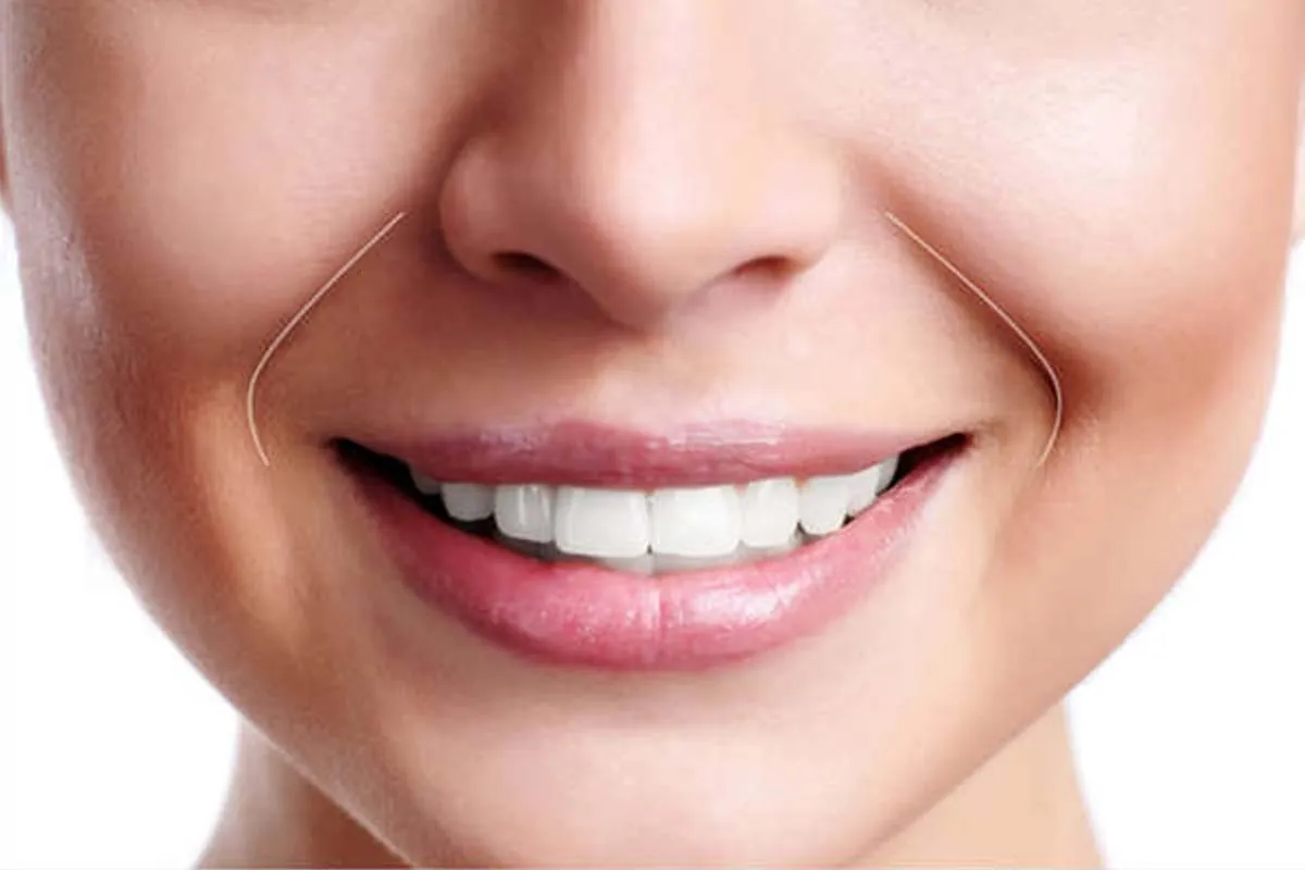 Arrugas del surco nasogeniano Primer plano sonrisa mujer con surco nasogeniano marcado