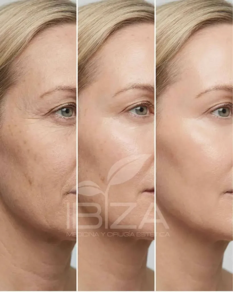 Hidratación facial: progresión antes y después